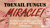  Toenail Fungus Miracle Logo